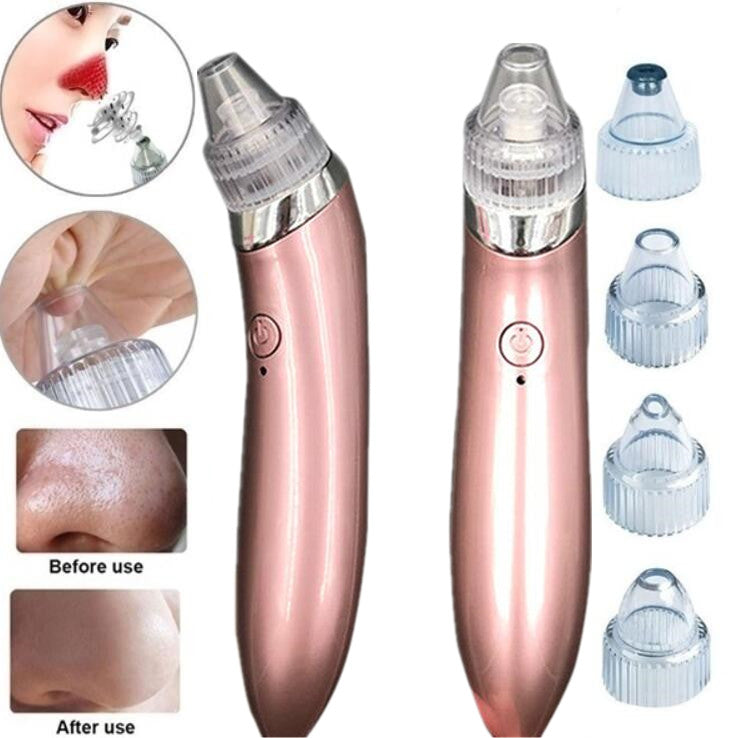 Removedor Extractor De Puntos Negros